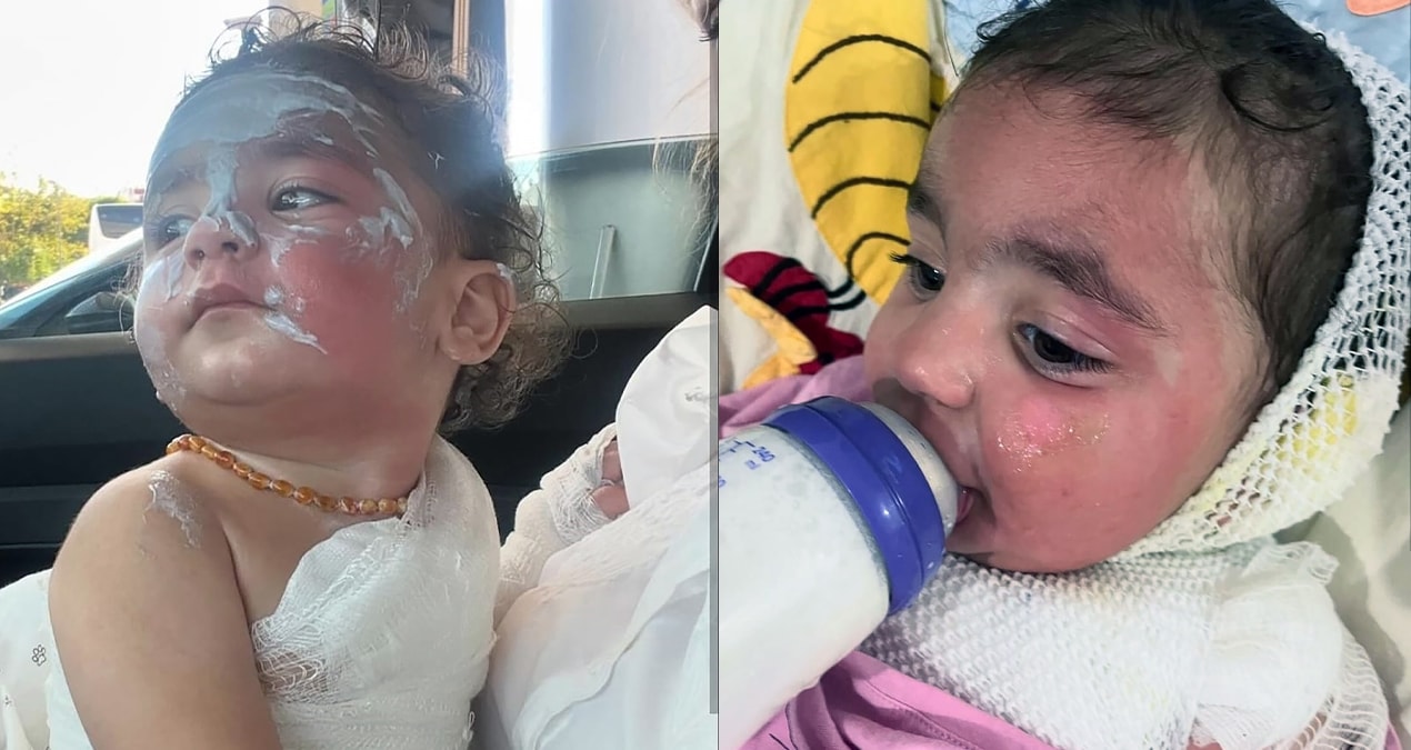 Kreşte kahve faciası: Aden bebek hastanelik oldu