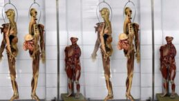 Doktor adayları için kadavra ithal ediliyor