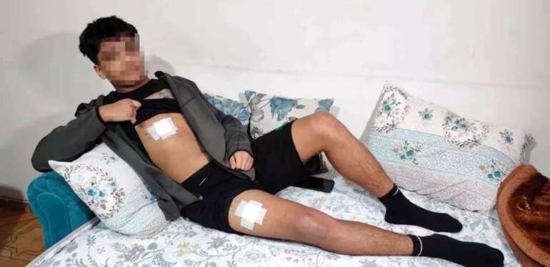 Akran zorbalığı az kalsın öldürüyordu: Önce dövüldü sonra bıçaklandı