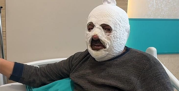 Arkadaşına ‘iyilik’ yapmak istedi, ‘ibretlik’ oldu: Ben yandım kimse yanmasın