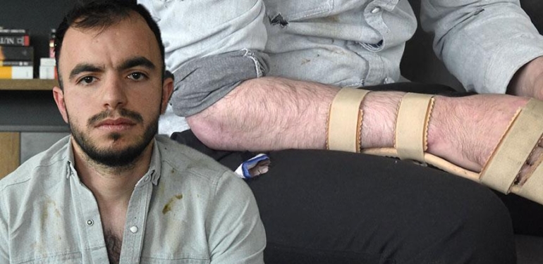 Başına metal saplandı, hayatı karardı! 18 milyon TL’lik rekor tazminat