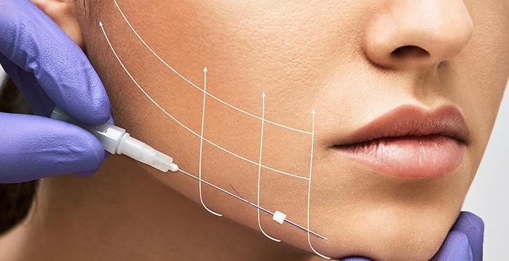 ‘Derin plan yüz germe’ tekniği kalıcılığıyla fark yaratıyor