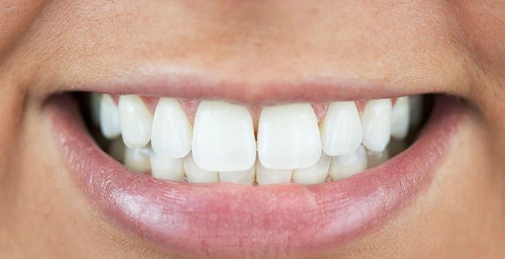 Dişleri bembeyaz yapıyor! Meğer püf noktası buymuş