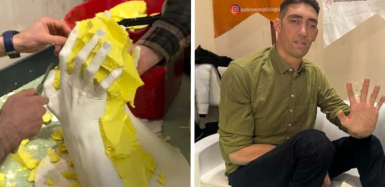 “Dünyanın en uzun adamı” Sultan Kösen’in ellerinin kalıbı alındı!