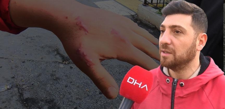 Evindeki Kedisi elini ısırdı, 13 gün sonra kabusu yaşadı: Dünya tıp literatüründe bir ilk