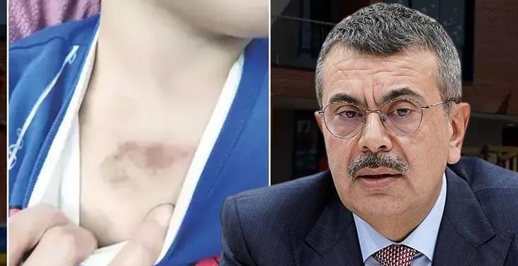 İBB kreşinde istismar ve darp iddiası! Bakan Tekin: Haklı olduğumuzu ortaya koydu