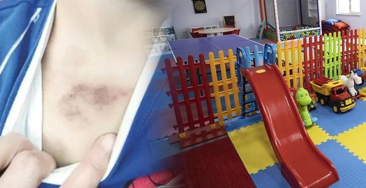 İBB kreşinde istismar ve darp iddiası! Sevk yazısı ortaya çıktı
