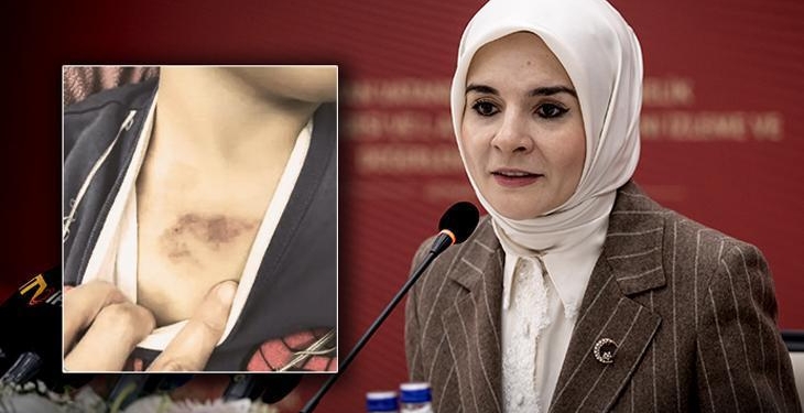 İBB’ye ait kreşte darp ve istismar iddiası! Bakan Göktaş: Maalesef farklı ihbarlar geliyor