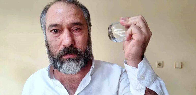 ‘Küfürlü konuşmayın’ diye uyardı, gözünden oldu