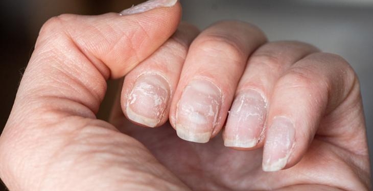 Maniküre ara verdiren kür! Evde yapılan doğal tırnak bakımı