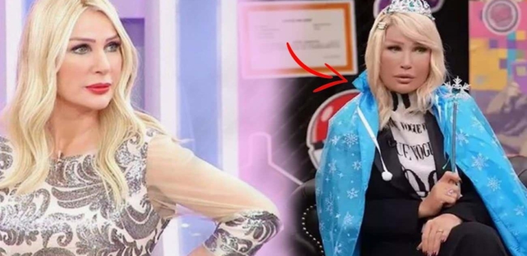 Seda Sayan’ın yüzü tanınmaz halde! Nedenini ilk kez açıkladı