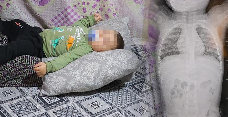 Bebeğin içinde ilerliyordu! 1 yıl boyunca ağladı: Tomografide korkunç gerçek