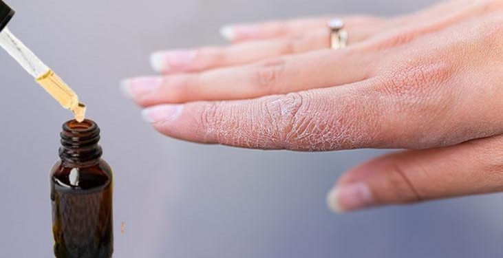 Eldeki çatlakları bir gecede pamuk gibi yapıyor! Cilt üzerinde bariyer etkisi