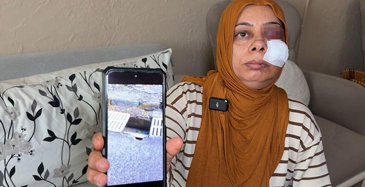 Elektrikli bisikletiyle rögara düştü! Dişleri kırıldı, yüzüne 14 dikiş atıldı