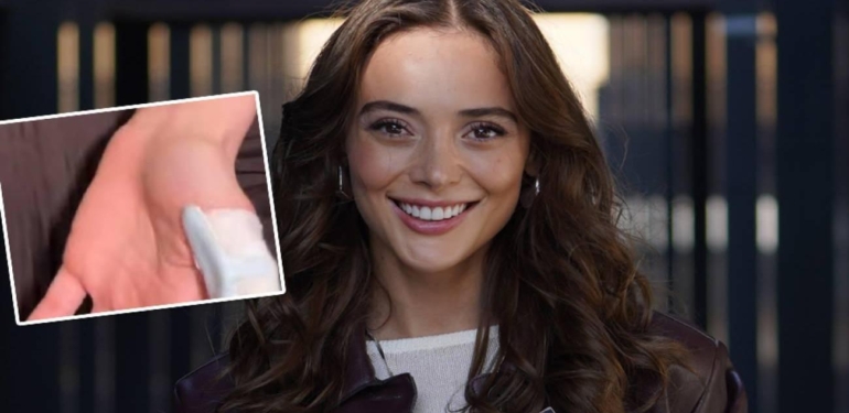 Rabia Soytürk sette kaza geçirdi! Parmağı kopma noktasına geldi