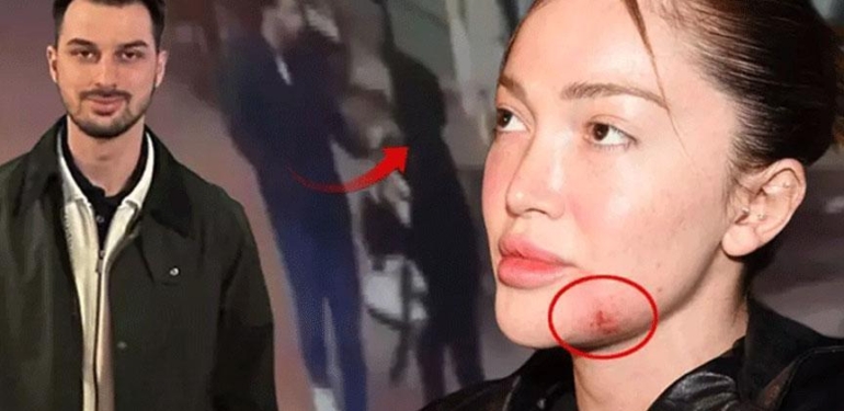 Son dakika… Fenomen Danla Biliç’i darbeden eski sevgilinin cezası belli oldu